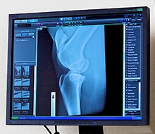 Remissinstans för bildavläsning